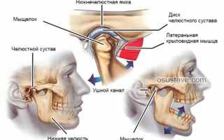 Артрит височно-нижнечелюстного сустава (ВНЧС): обзор, причины и лечение