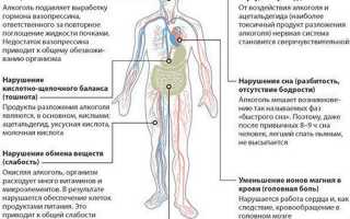 Как избавиться от тошноты от похмелья