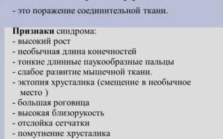 Синдром Марфана: симптомы со стороны сердца и сосудов, диагностика, лечение