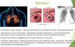 Курение при бронхите: последствия