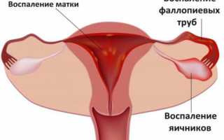 Причины боли в пояснице и запора одновременно