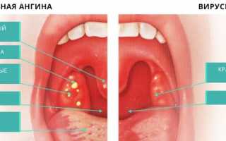 Курение при ангине: что будет