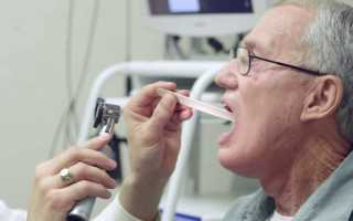 Сколько живут с раком горла: стадии заболевания и прогноз жизни