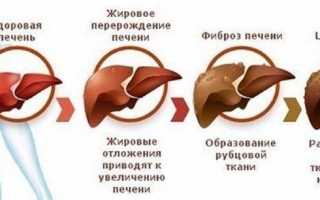 Алкогольная интоксикация печени: симптомы