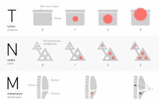 Классификация TNM: принципы систематизирования и ее виды